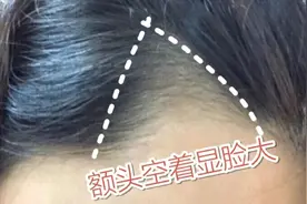 脱发掉发太严重？教你1秒修饰发际线，从此告别大脑门高额头！