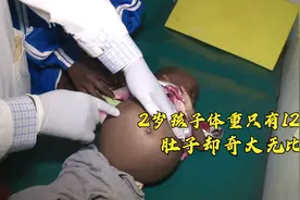 2岁孩子体重只有12斤，四肢瘦小肚子却奇大无比，妈妈也无能无力视频封面
