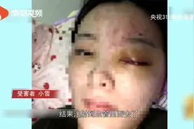 央视曝光医美乱象一个正规的医美执业资格是什么样的？视频封面