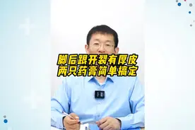 脚后跟开裂有厚皮，两只药膏简单搞定