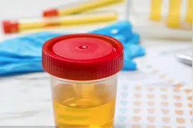 尿沉淀检查的细菌高怎么办？不用怕，医生给出了明确答案视频封面