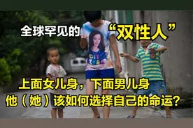 全球罕见的双性人，上半身女性下半身男性，该怎样选择命运呢视频封面
