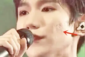 王源脸部痤疮严重被嘲烂脸？镜头下真实颜值曝光，网友：别吸烟了视频封面