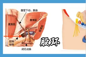 腹股沟区：股环