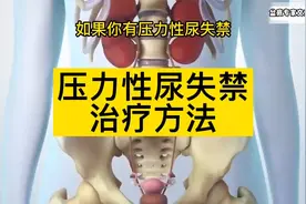 3个成年女性就有1个尿失禁~视频封面