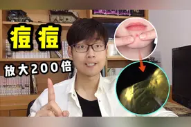 痘痘里为什么能挤出硬的东西？放大200倍像一颗大宝石