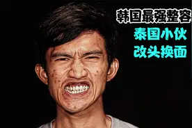 韩国最强整容术 泰国小伙改头换面视频封面