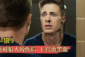 小伙被狼人咬伤后身体异变，鲜血变的如墨般，荷尔蒙爆棚的狼人片视频封面