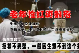 女子亲人相继去世，面部长红斑去医院检查，不经意间查出恶性疾病视频封面