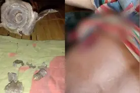 熊孩子！缅甸一群小孩捡到一颗炮弹，用刀敲击结果当场直接爆炸视频封面