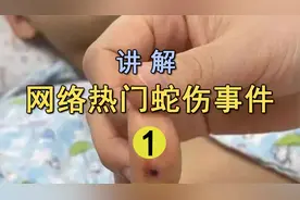 广西9岁男孩把玩“无毒”野鸡蛇!竟然被咬进ICU?野鸡蛇真的是无毒视频封面