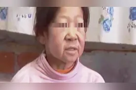 才12岁的孩子 却是一副老态龙钟的样子 面容看着像是七八十岁