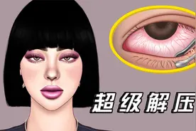 超级解压！美女熬夜加班眼睛疼，医生挤出一大堆皮下脂肪！