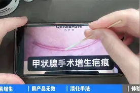 清巴师：脖子处做手术后出现疤痕增生该怎么办？视频封面