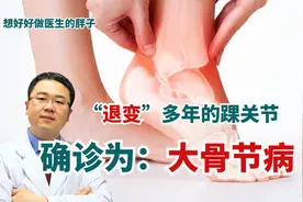 脚踝疼痛多年，自认为退变所致！经医生诊断，确诊竟为：大骨节病视频封面