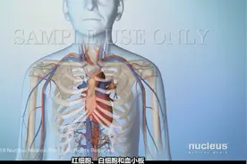 【Nucleus Medical Media】什么是白血病视频封面