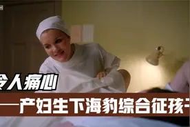 令人痛心，产妇生下海豹综合征孩子（分娩片段）视频封面