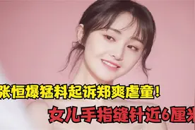 张恒爆料起诉郑爽虐童，女儿手指缝针近6厘米！抚养权最终归谁？视频封面