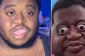 奇人！美国一喜剧演员骨骼清奇 随时能把眼球挤出眼窝视频封面