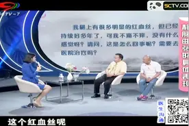 腿上出现明显的红血丝，但不痛不痒没感觉，这是不是静脉曲张呢？