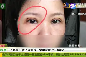 杭州甄美做双眼皮 觉得像斗鸡眼饭都吃不下 杨女士想退费能否如愿视频封面
