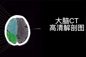 颅脑CT高清解剖图谱视频版，附带详细标注视频封面