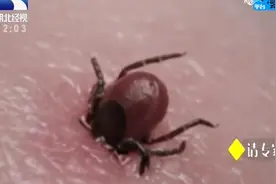 户外活动被蜱虫叮咬，该如何处理？来听听医生怎么说视频封面