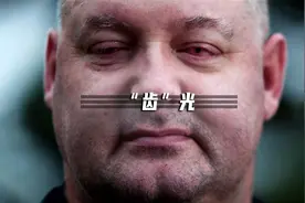 盲人福音！把牙齿“种”进眼睛，就能重见光明视频封面