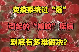 免疫系统过“强”引起的“狼咬”疾病，到底有多难解决？视频封面