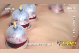 刺络放血是将点刺放血与拔罐相结合，疏通瘀堵作用更强丨健康之路视频封面
