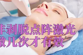 非剥脱点阵激光做几次才有效视频封面