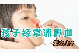 孩子经常流鼻血，怎么办？医生有妙招，做好3件事，轻松预防