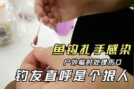 被鱼钩刺伤手指导致感染，咬牙处理伤口，钓友直呼是个狠人视频封面