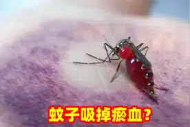 蚊子把瘀血吸干？这是什么操作？蚊子：这血怎么过期啦视频封面