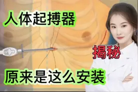 医学演绎 心脏病患者如何安装起搏器 看医生如何操作固定视频封面