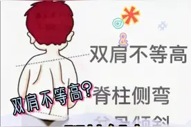 脊柱侧弯需要做哪些检查？拍什么片子？视频封面