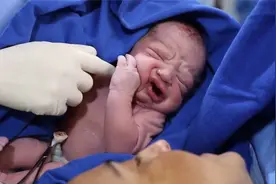 实录产妇超艰辛的剖腹产生子经历，妈妈的泪水令人感动又心疼！视频封面