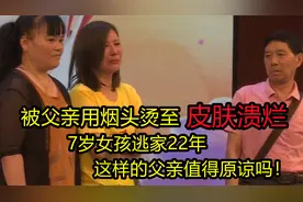 被父亲用烟头烫至皮肤溃烂，7岁女孩逃家22年，父亲：她太调皮了视频封面