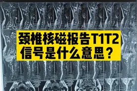 颈椎核磁共振报告上写了T1 T2信号异常是什么意思视频封面