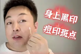 药房见到这个“小软膏”要拿下，每天涂两次，皮肤黑印轻松去