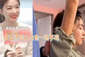 万茜车祸后骨折复健直呼心累：用尽洪荒之力，手却一动不动视频封面