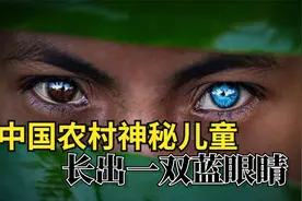 农村孩子长出蓝色眼睛，视力超群半夜发光，专家检查为何说不好？视频封面