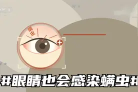警惕！#眼睛也会感染螨虫#视频封面