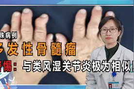 特殊疾病：会“伪装的肿瘤”，与类风湿关节炎一样的表现！视频封面