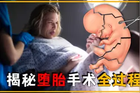 你知道堕胎手术有多痛苦吗？看完这个视频，你还忍心吗？视频封面