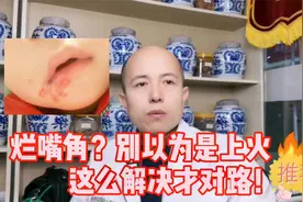 烂嘴角、长泡泡别总以为上火！内调外用，辨证解决才有效！视频封面