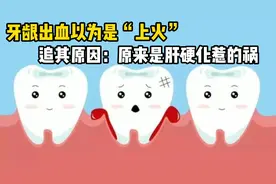 牙龈出血以为是“上火”，追其原因：原来是肝硬化惹的祸