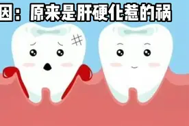 牙龈出血以为是“上火”，追其原因：原来是肝硬化惹的祸视频封面