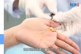 手脚出现水泡，别用手挤！医生教你这样处理！视频封面