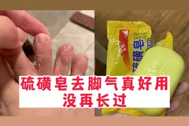 硫磺皂去脚气真的好用！脚臭脚痒一招断根了！开心